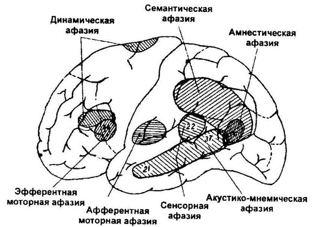 поражение долей мозга